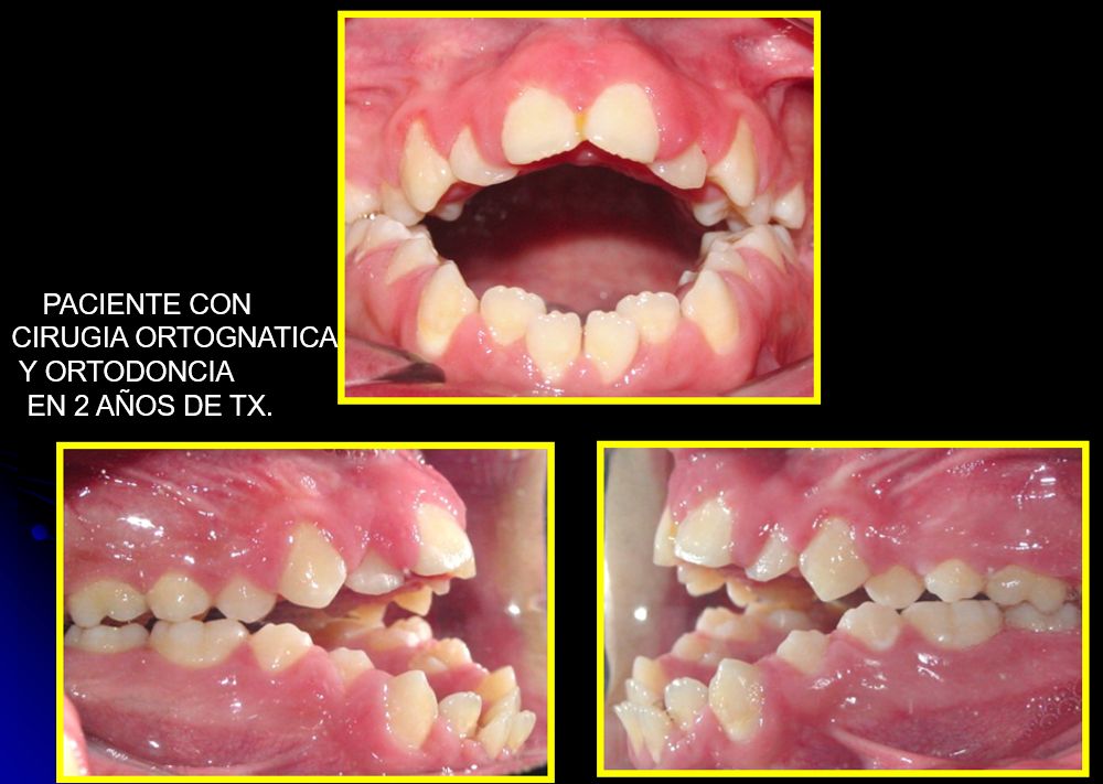 Victor Hugo Sepulveda Núñez-0