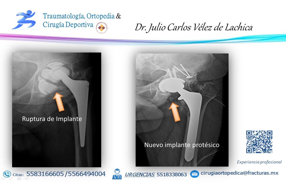 Julio Carlos Vélez De Lachica-7