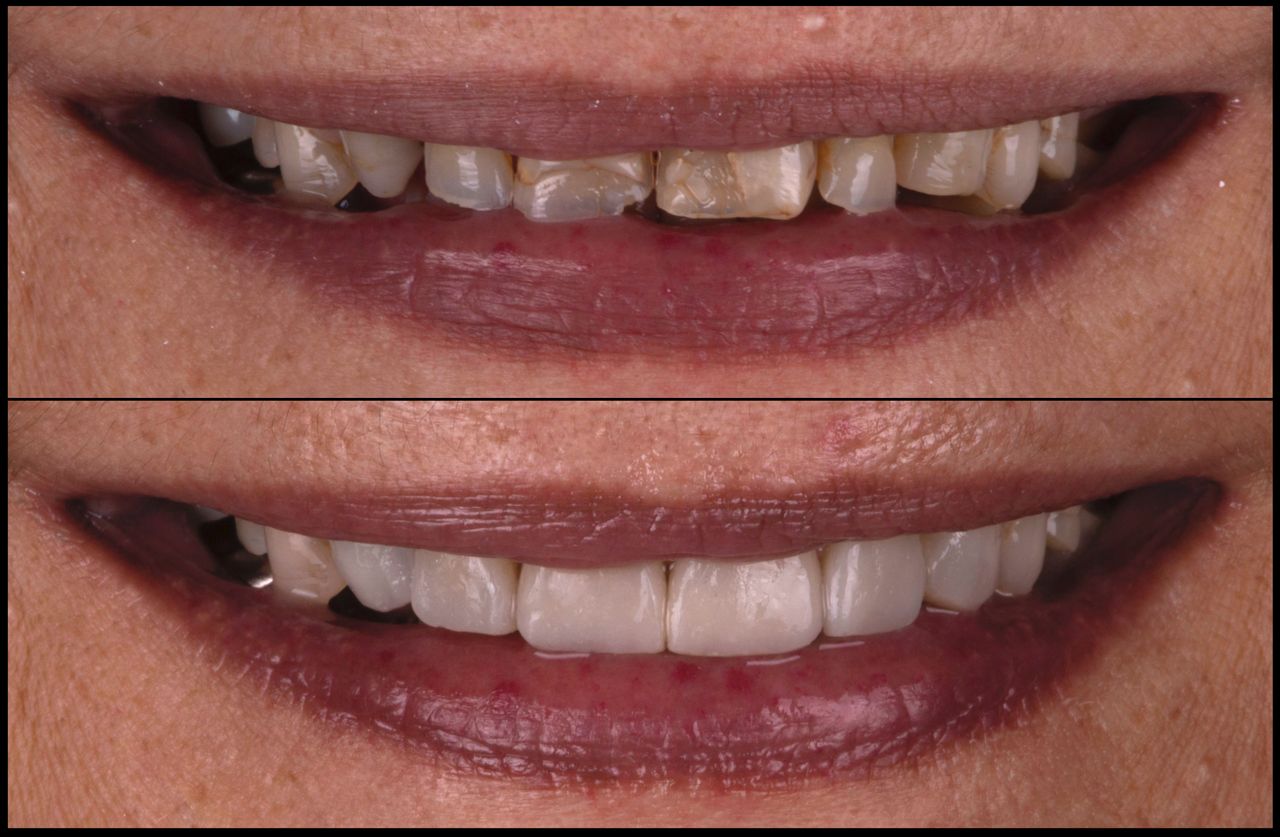 María Fernanda González Gastelum-4