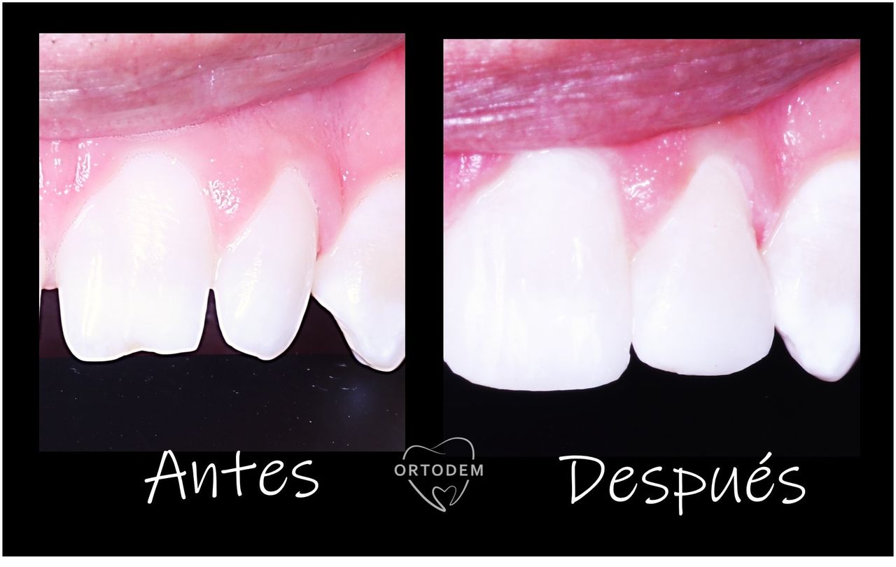 Elizabeth Morelos Morales-17