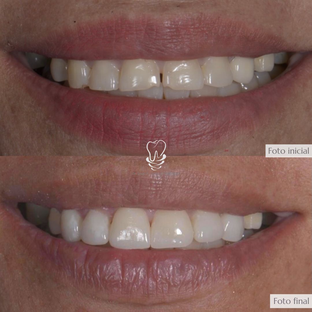 Jorge Rafael Calderón Velázquez-14