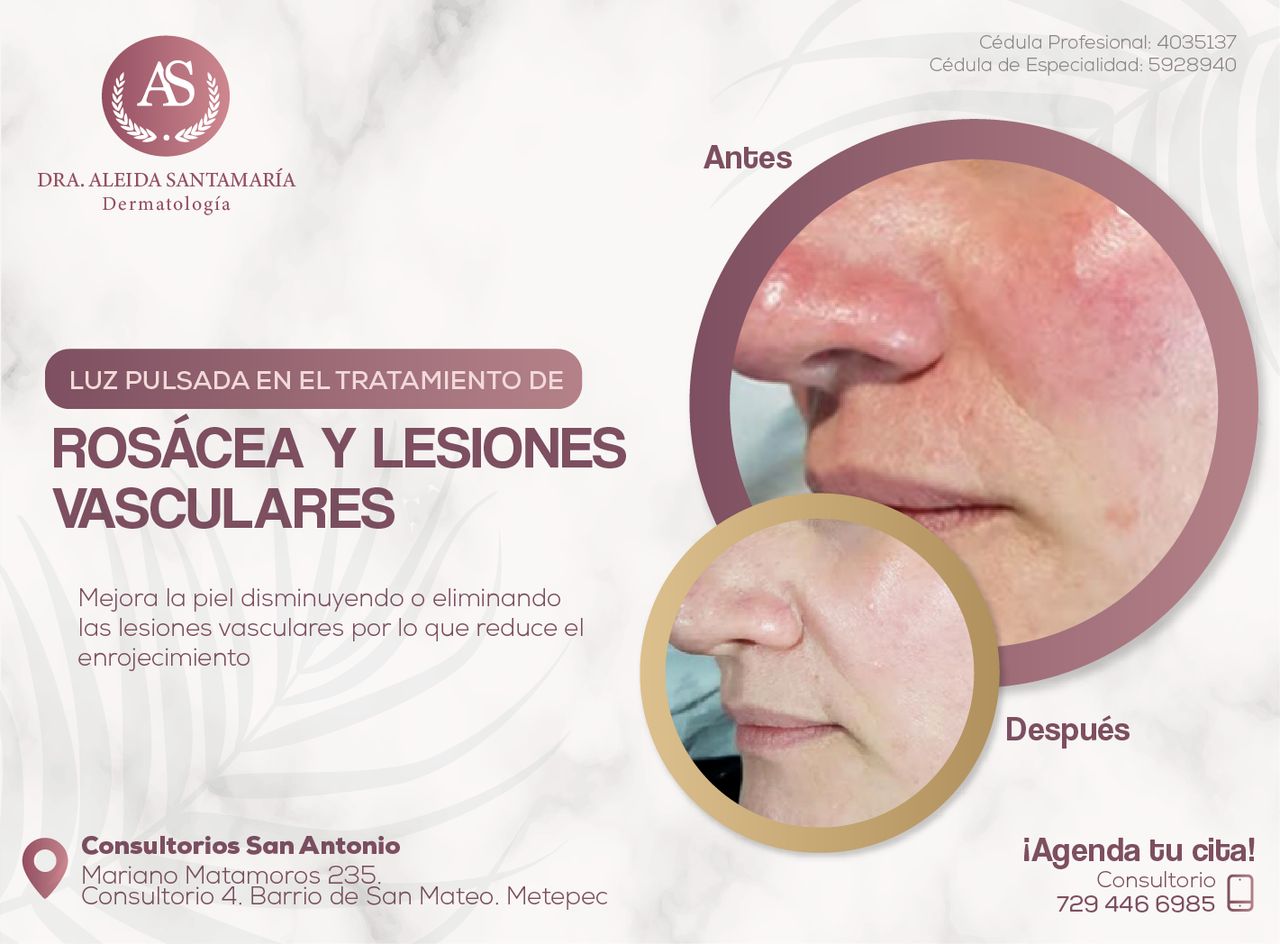 Aleida Santamaria Roman-1