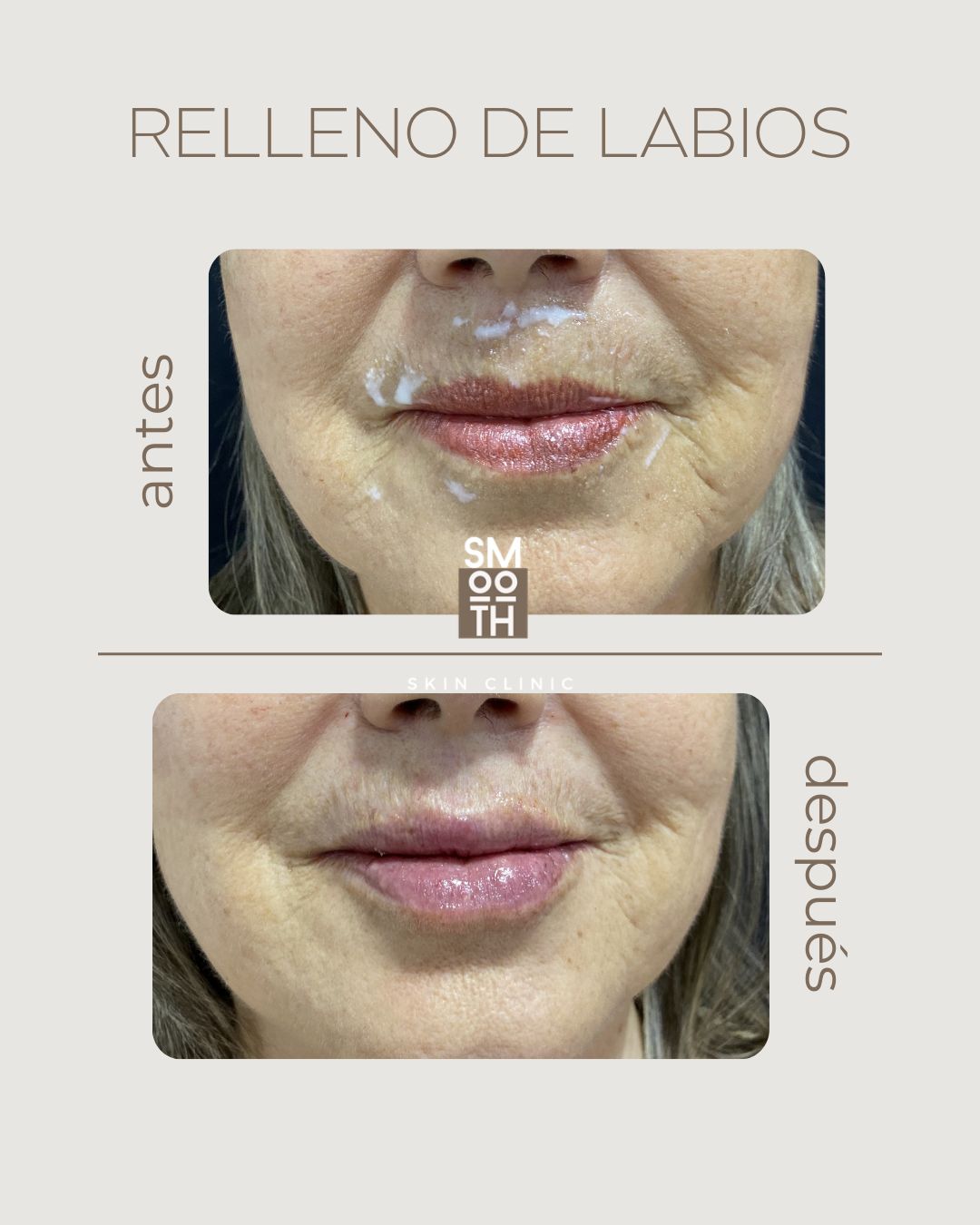 Samantha Martínez-40