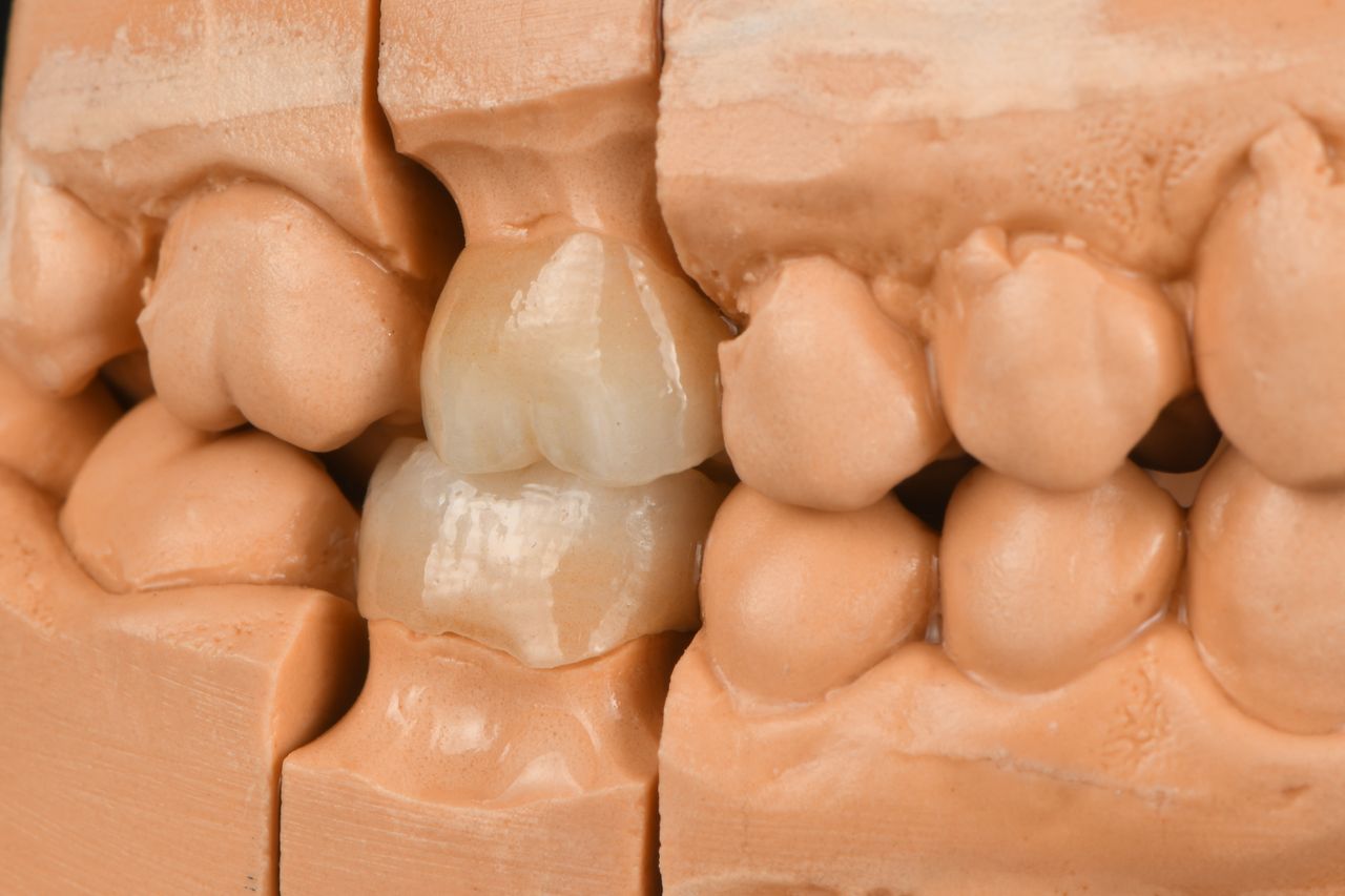 Ricardo López Lemus-38