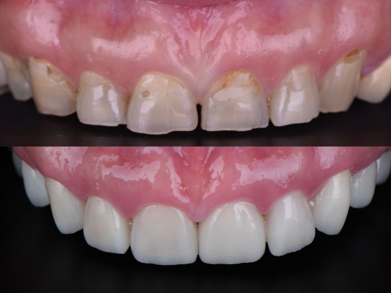 Irving Quezada Lara-11