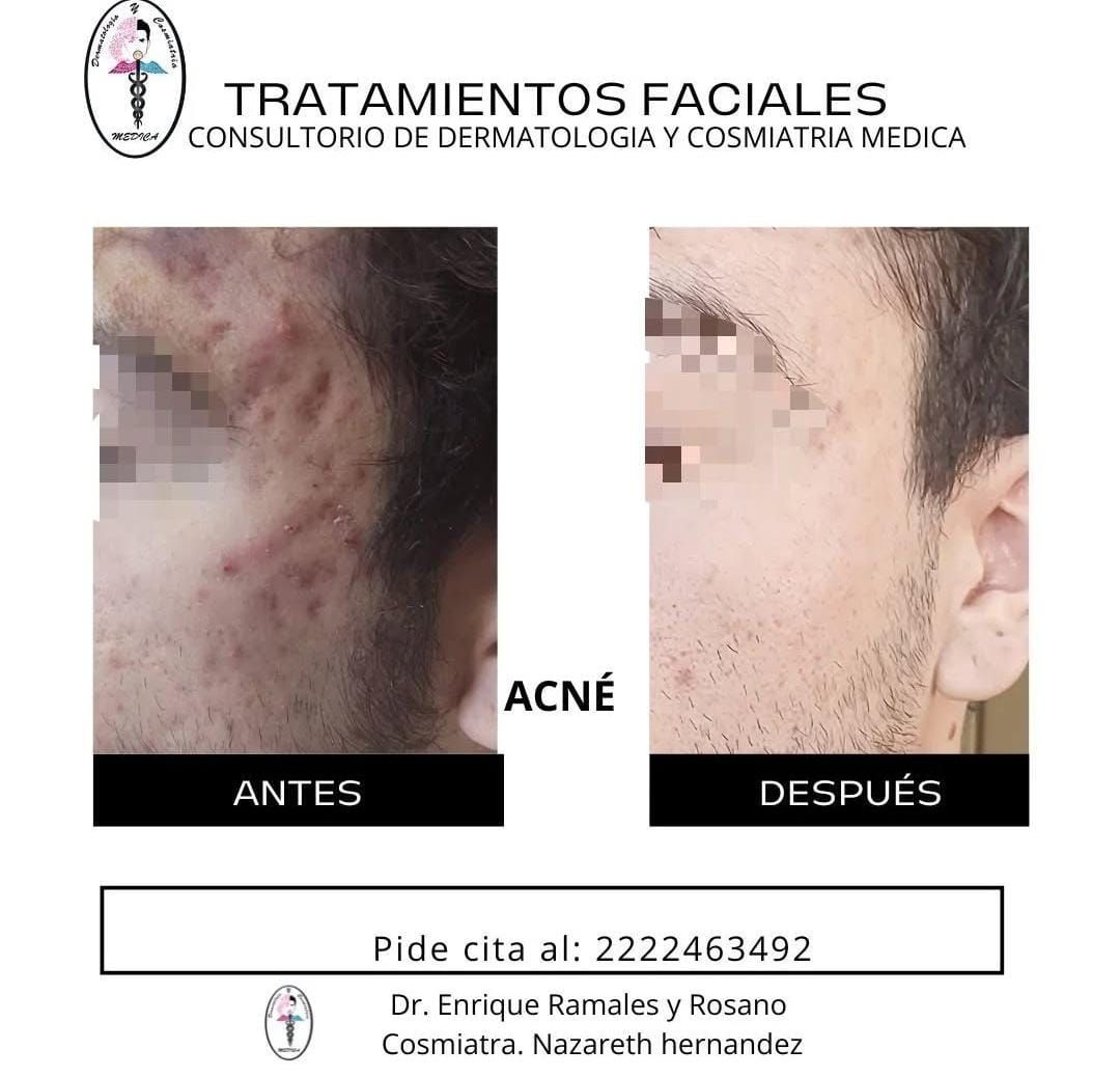 Enrique Ramales Rosano-6