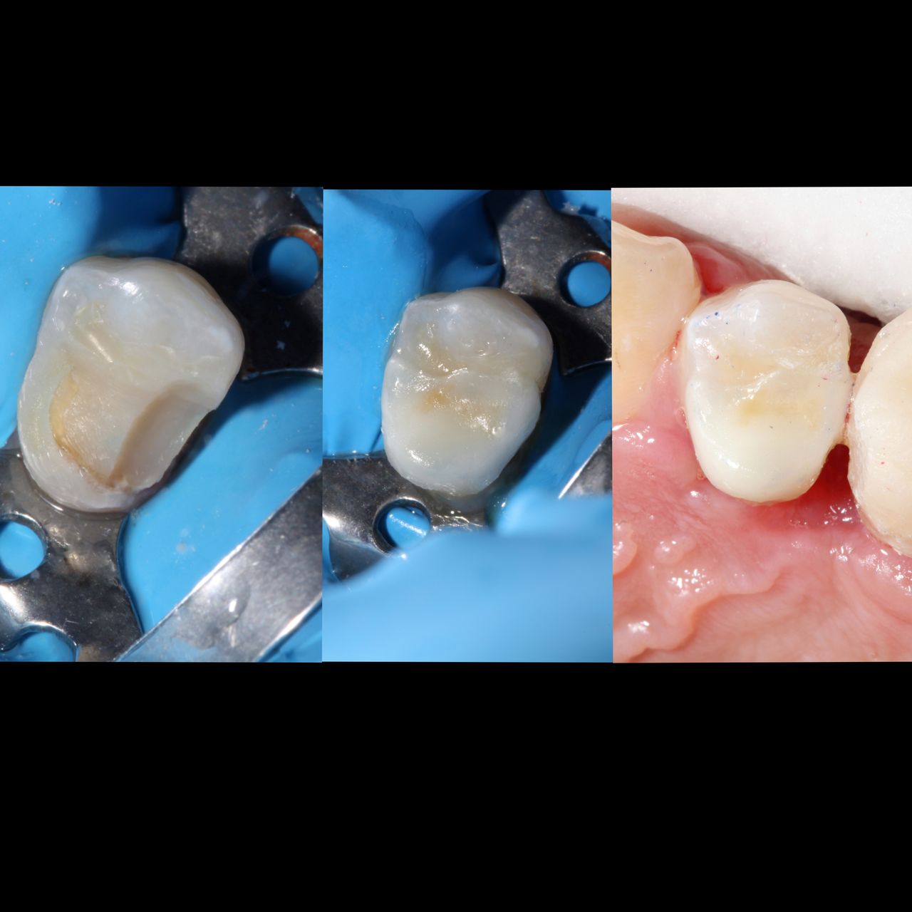 Hylse Najera Moya-26