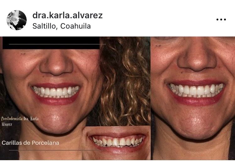 Karla Alvarez Treviño-9
