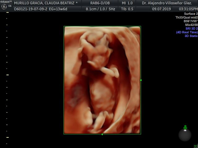 Alejandro Villaseñor Gonzalez-6