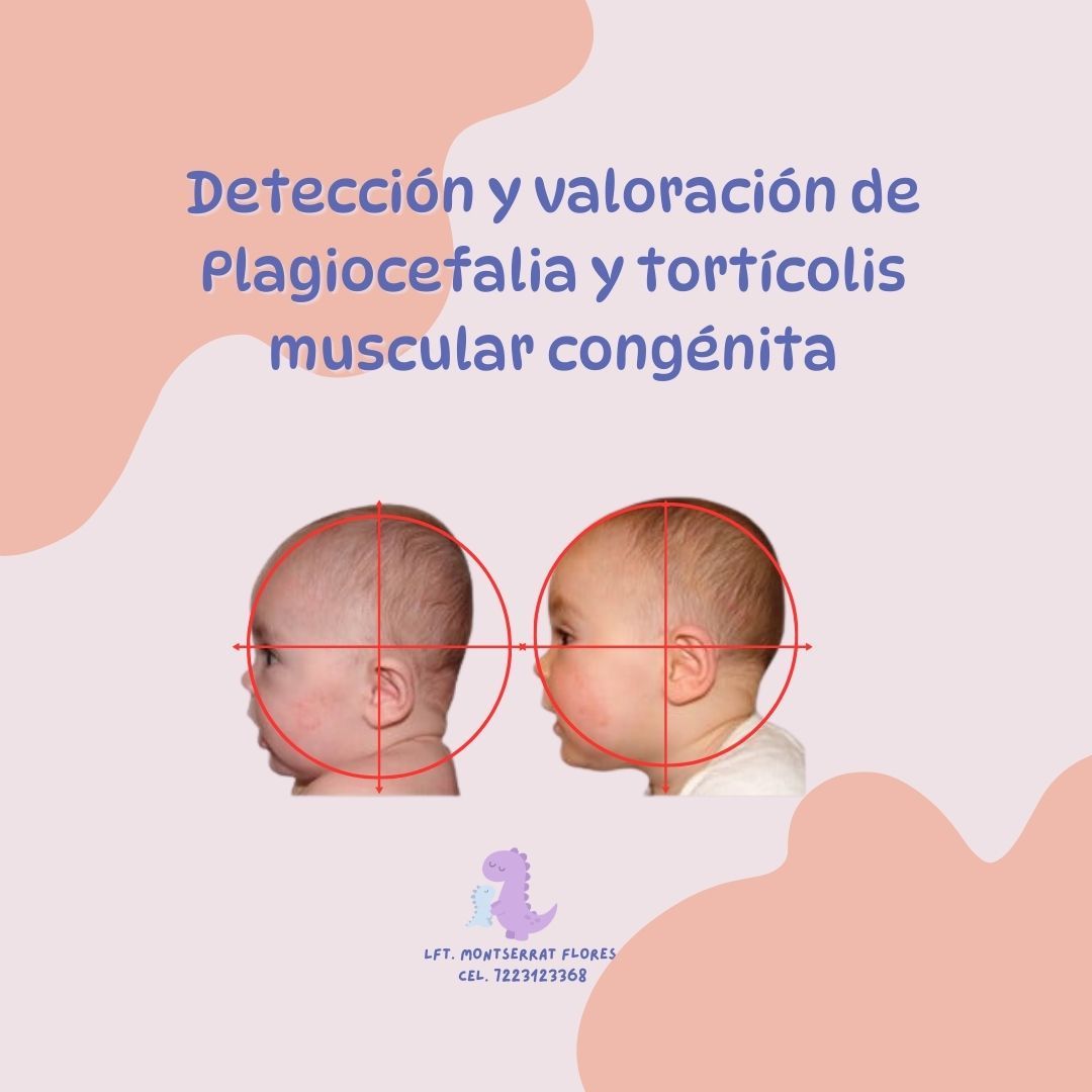 Montserrat Flores-14