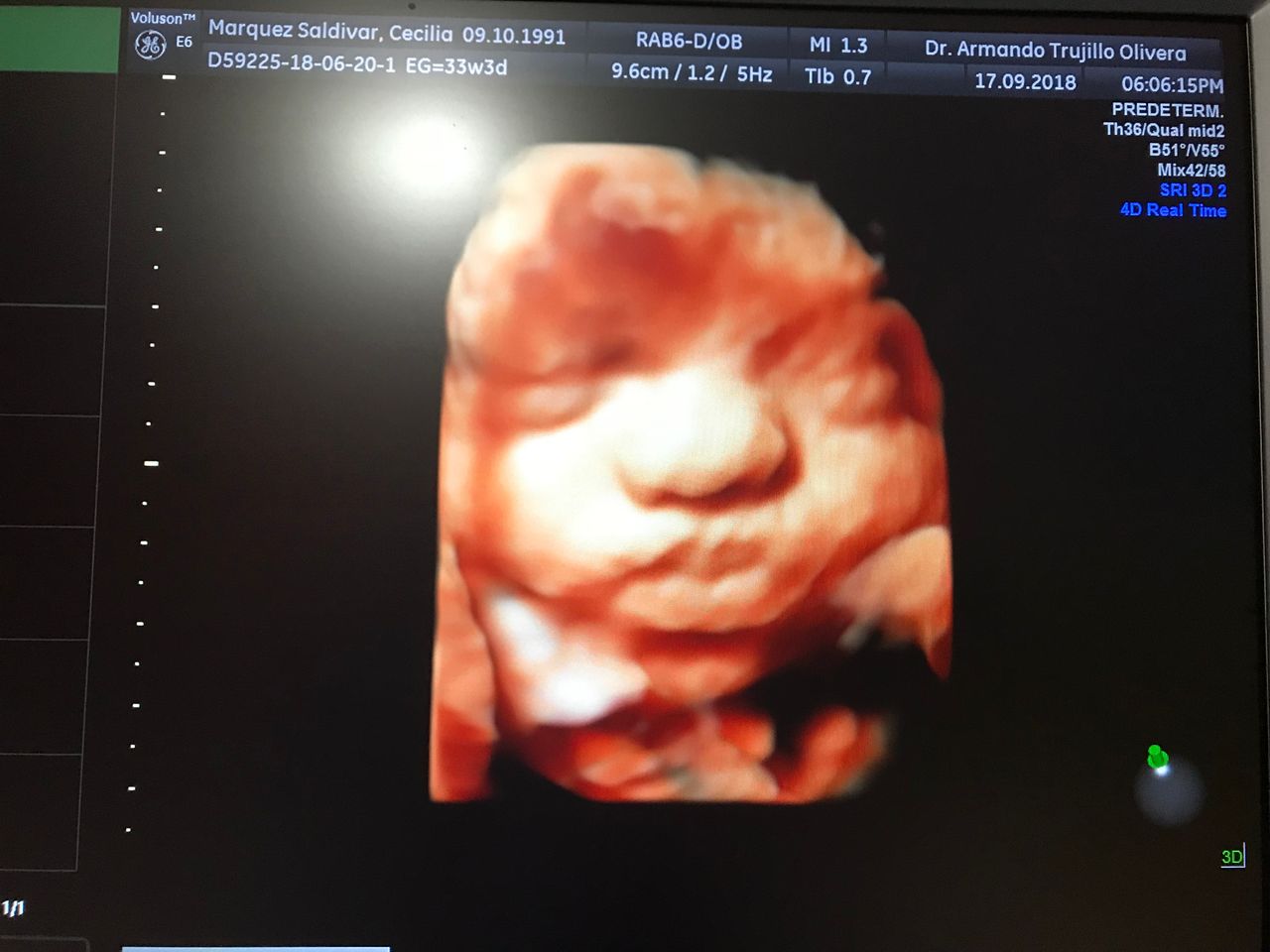 Armando Trujillo Olivera-7