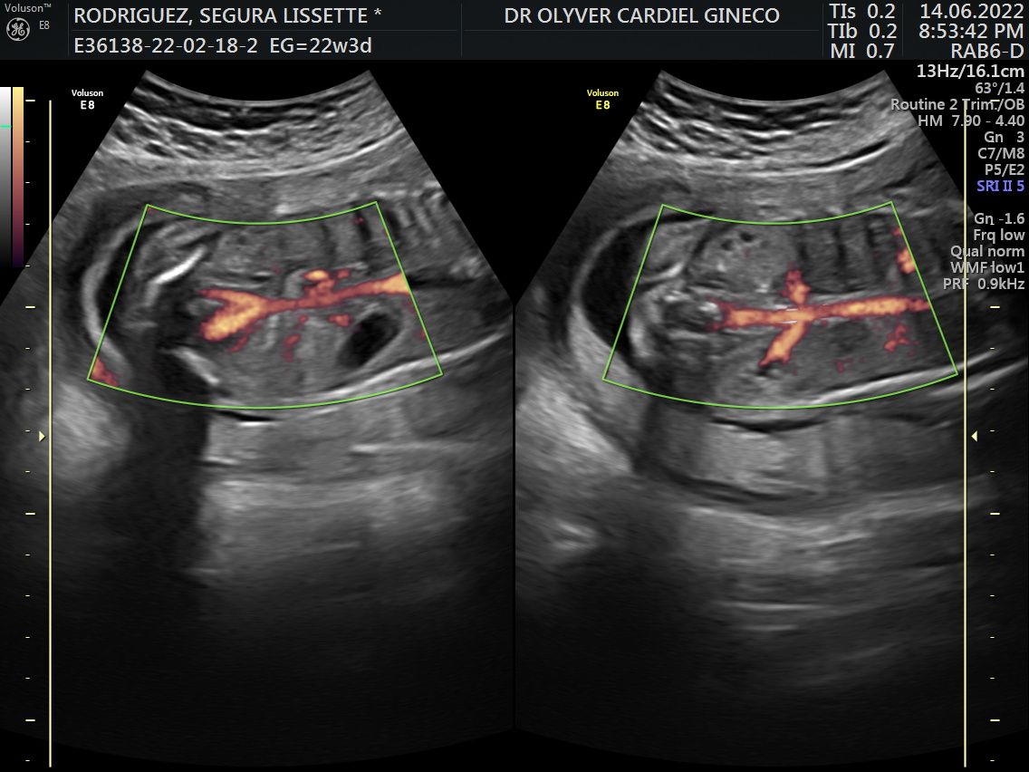 Olyver Cardiel Rivera-11