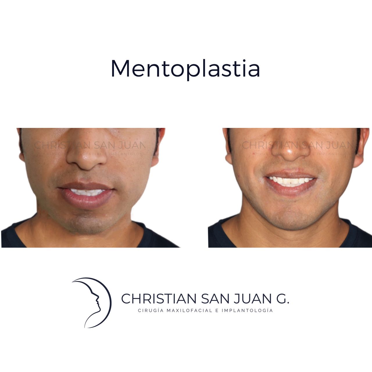 Christian San Juan González-6