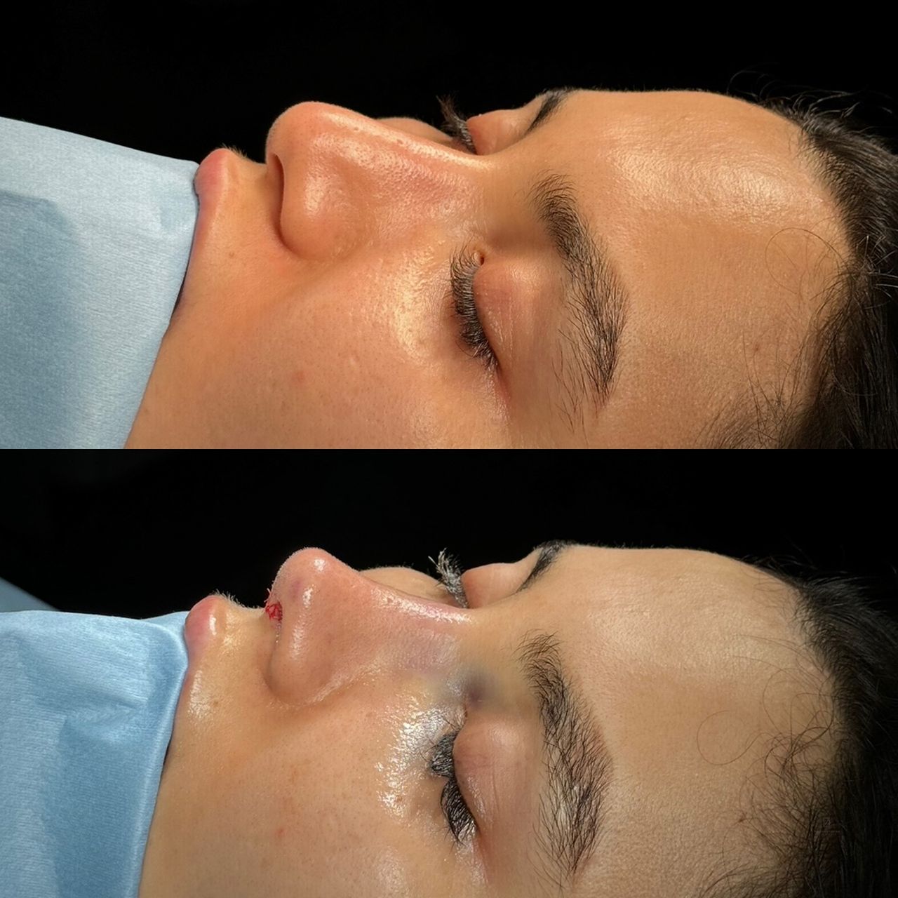 Angel Castro Urquizo-51