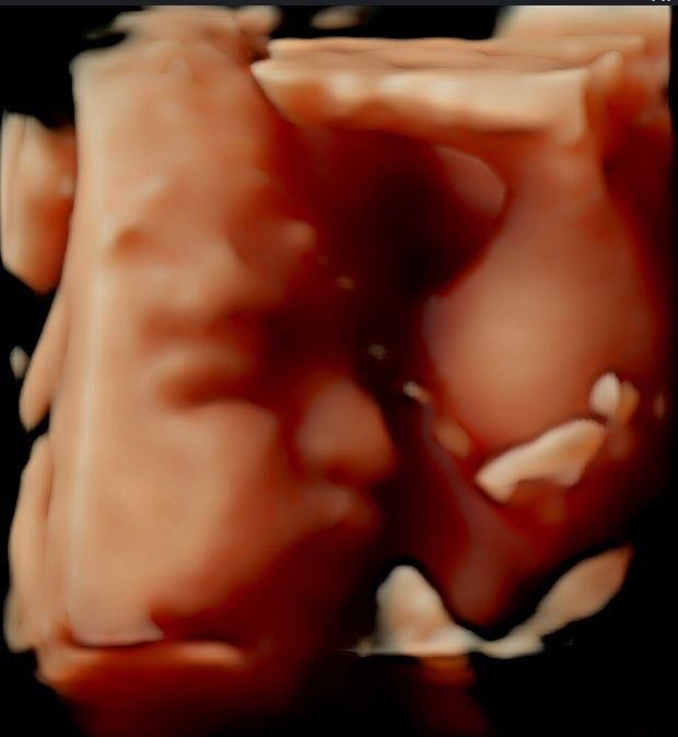 Myriam Barajas Calvillo-4