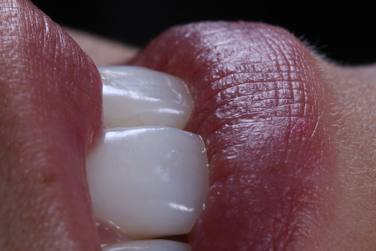 Ernesto Rojas Calderon-29