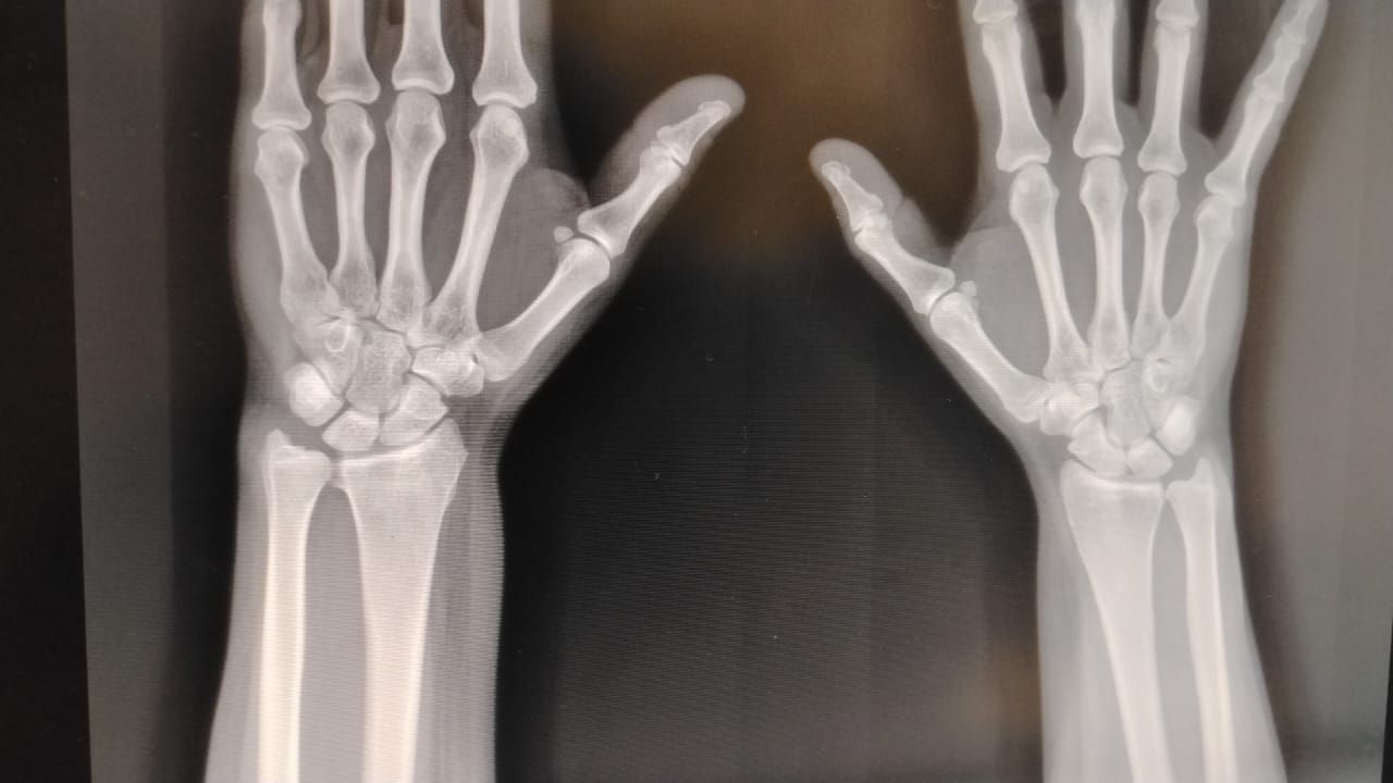 Alejandro Irisson-23