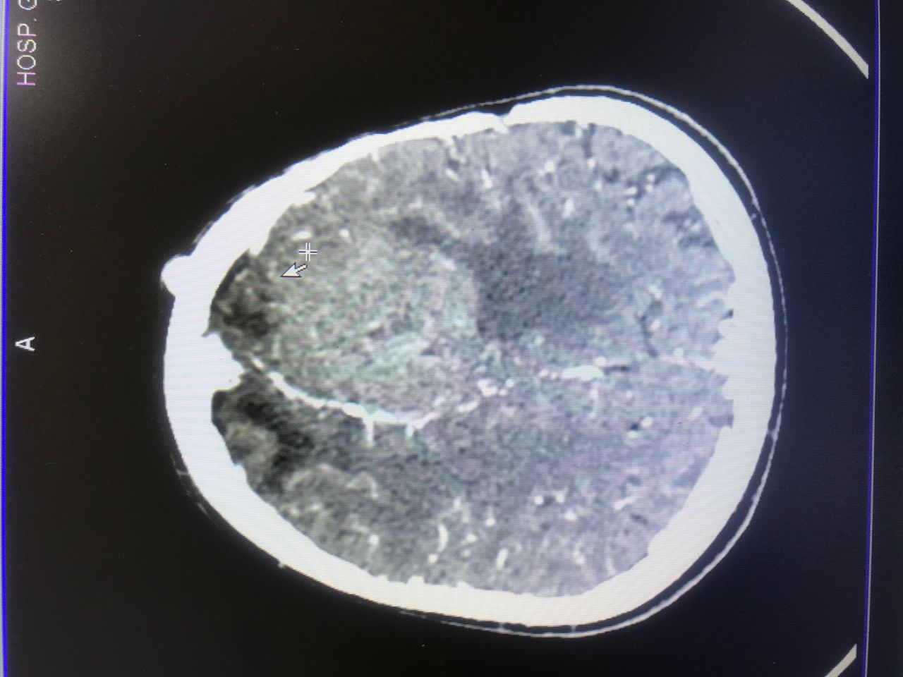 Rafael Maciel Morfin-24