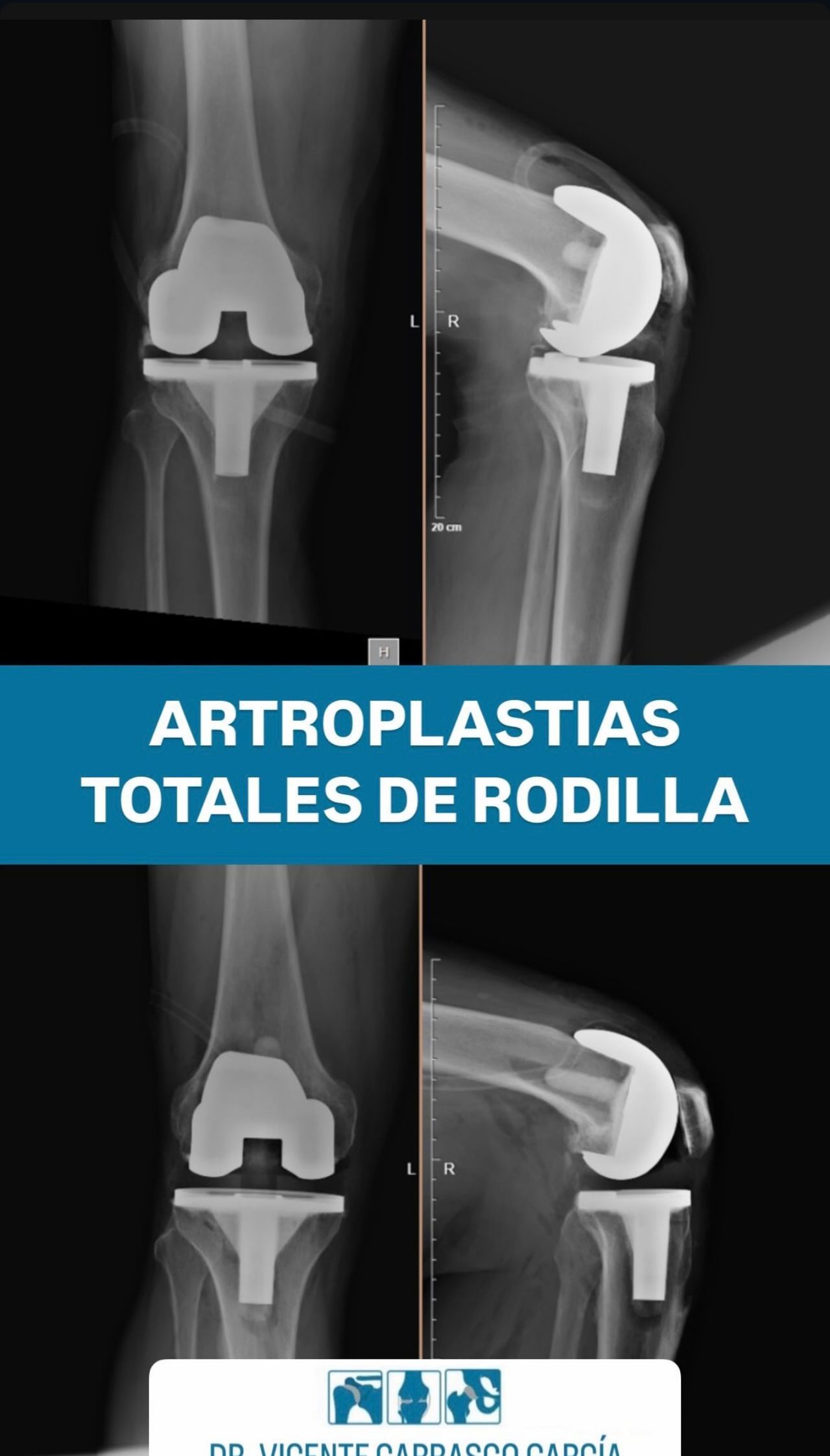 Vicente Carrasco García-5