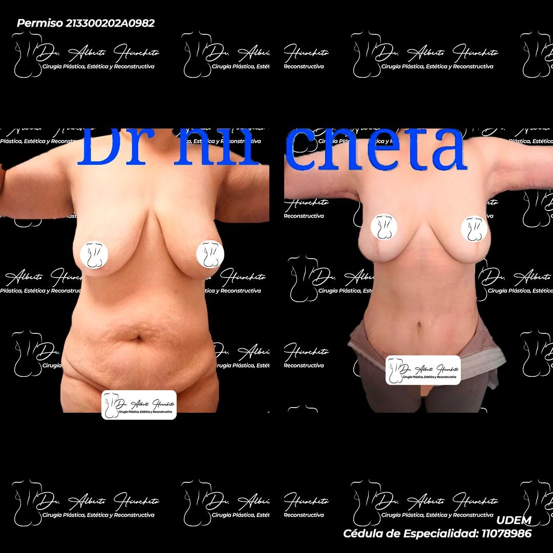 Alberto Hiracheta Torres-20