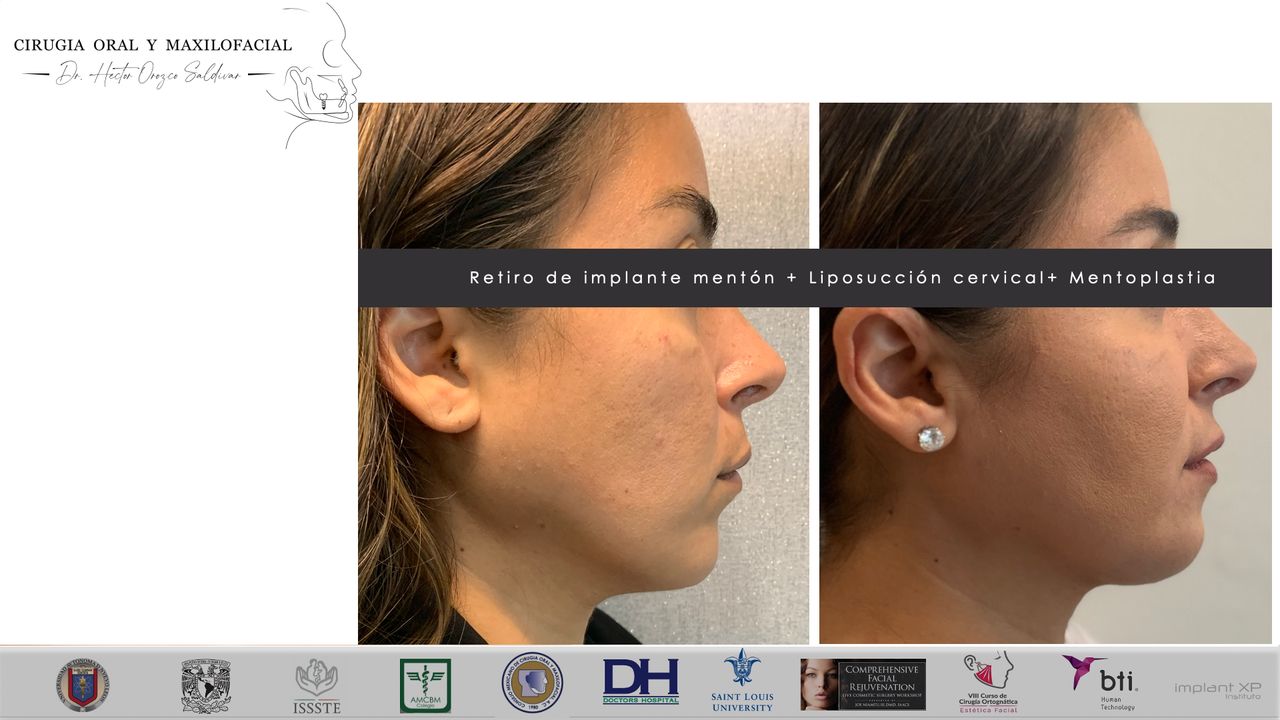 Héctor Adolfo Orozco Saldívar-31