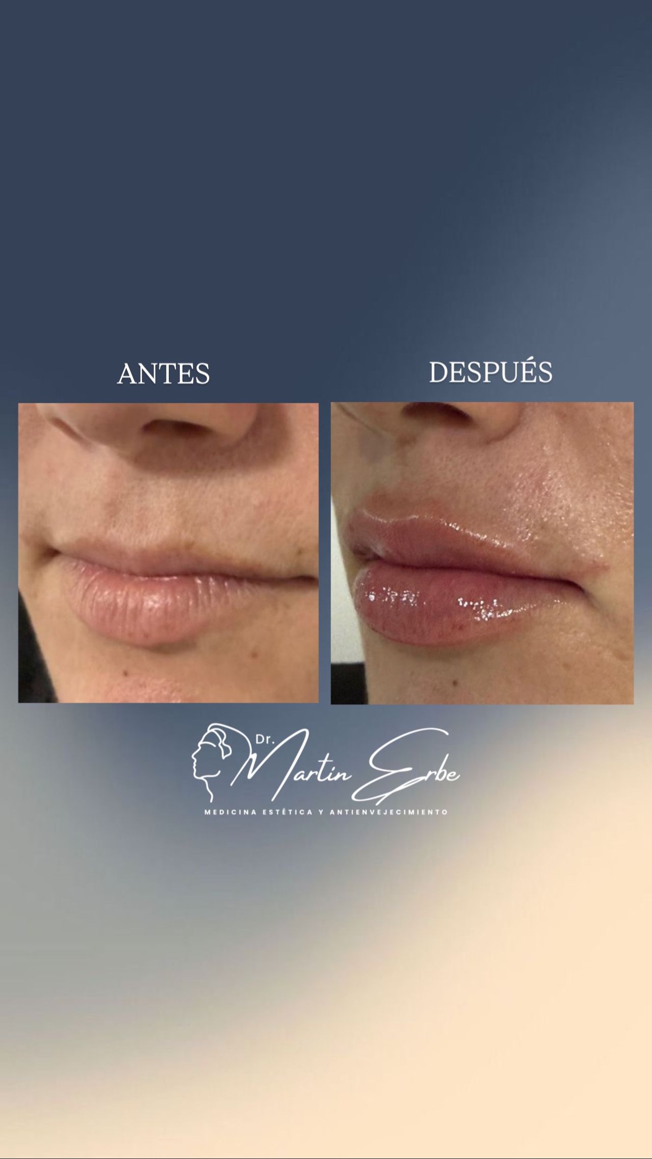 Martin Medina Erbe-13