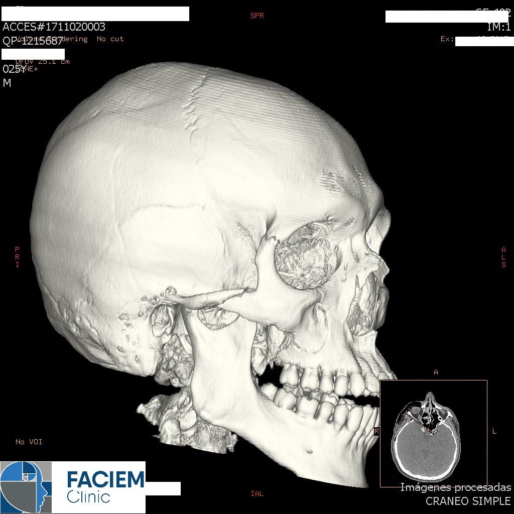 Arlen Colín Ordaz-33