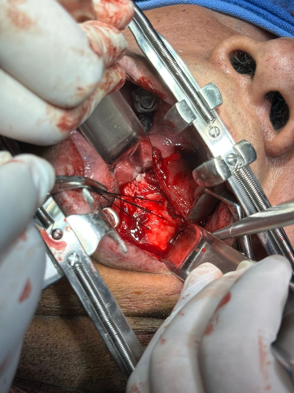 Martin Alberto Hernandez Cardenas-12