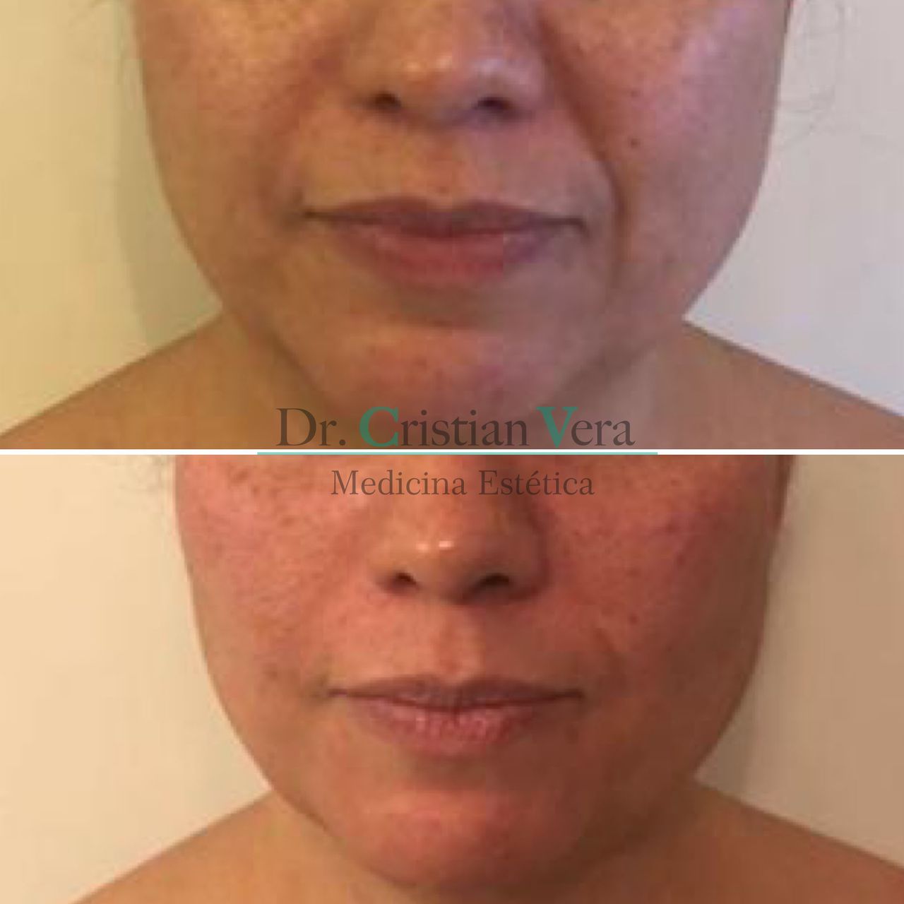 Cristian Eduardo Vera Nuño-16