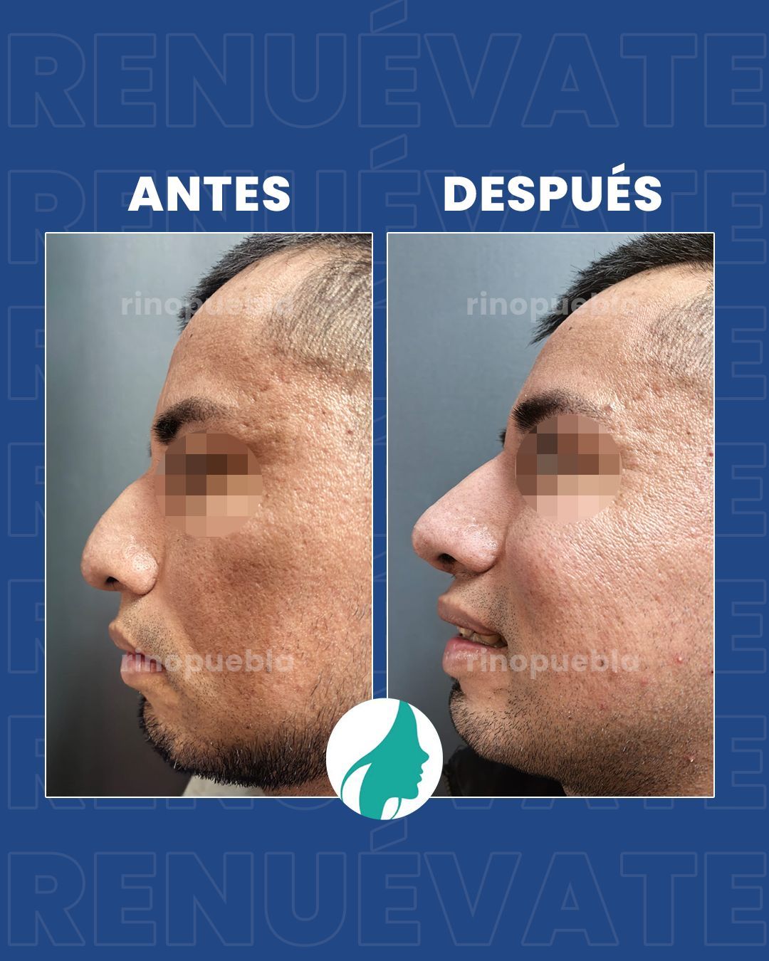 Christian Santander Becerra-39