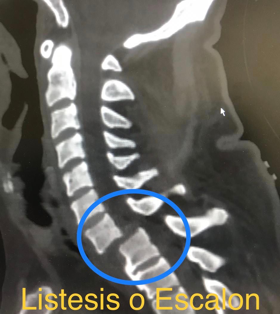 Rafael Maciel Morfin-53