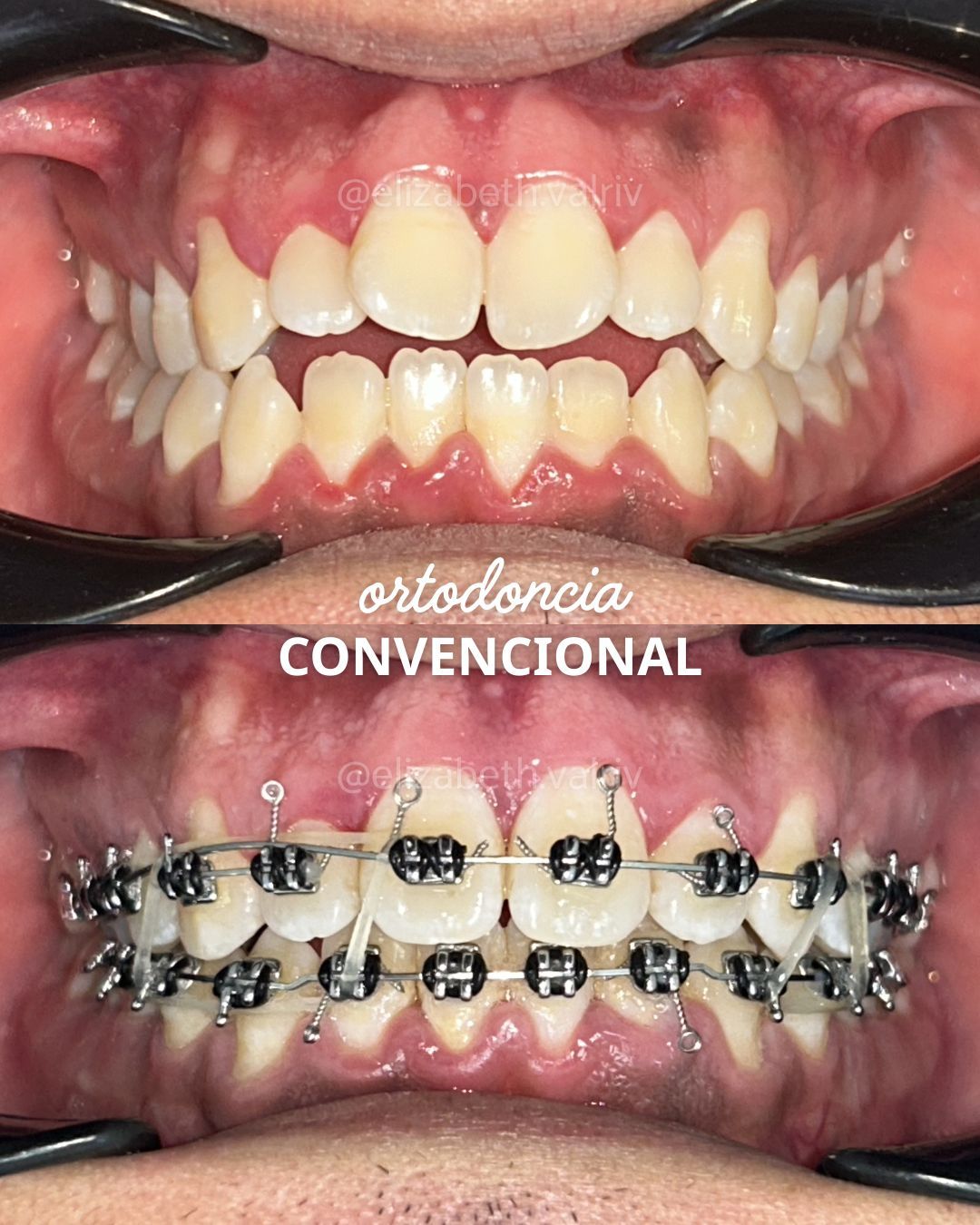 Elizabeth Valenzuela Rivera-6