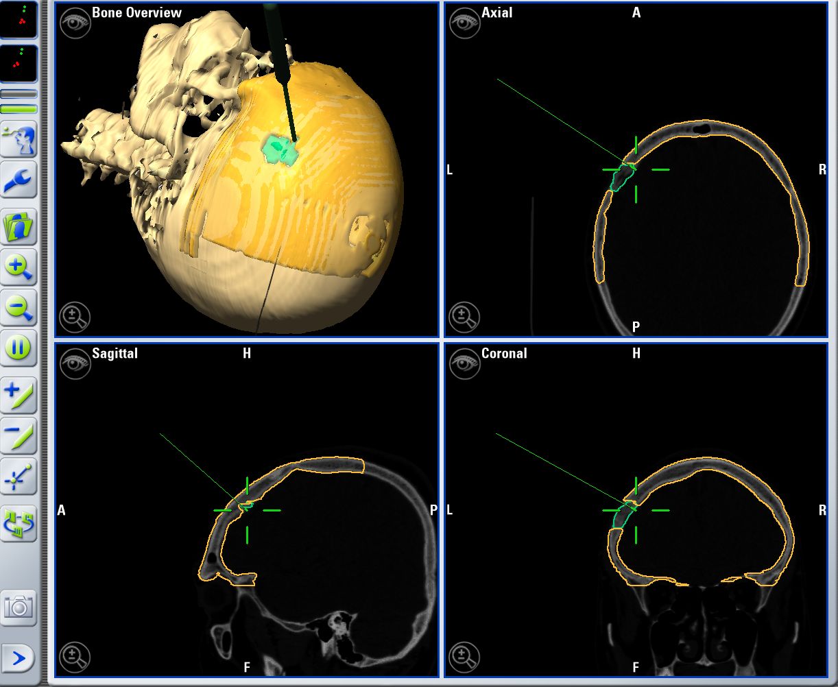 Enrique De Obieta Cruz-28