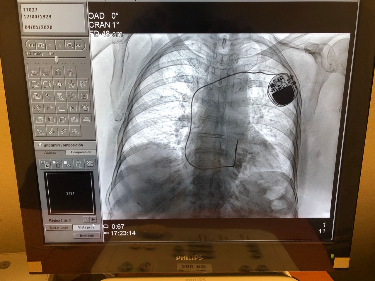 José Ramón Benítez Tirado-4