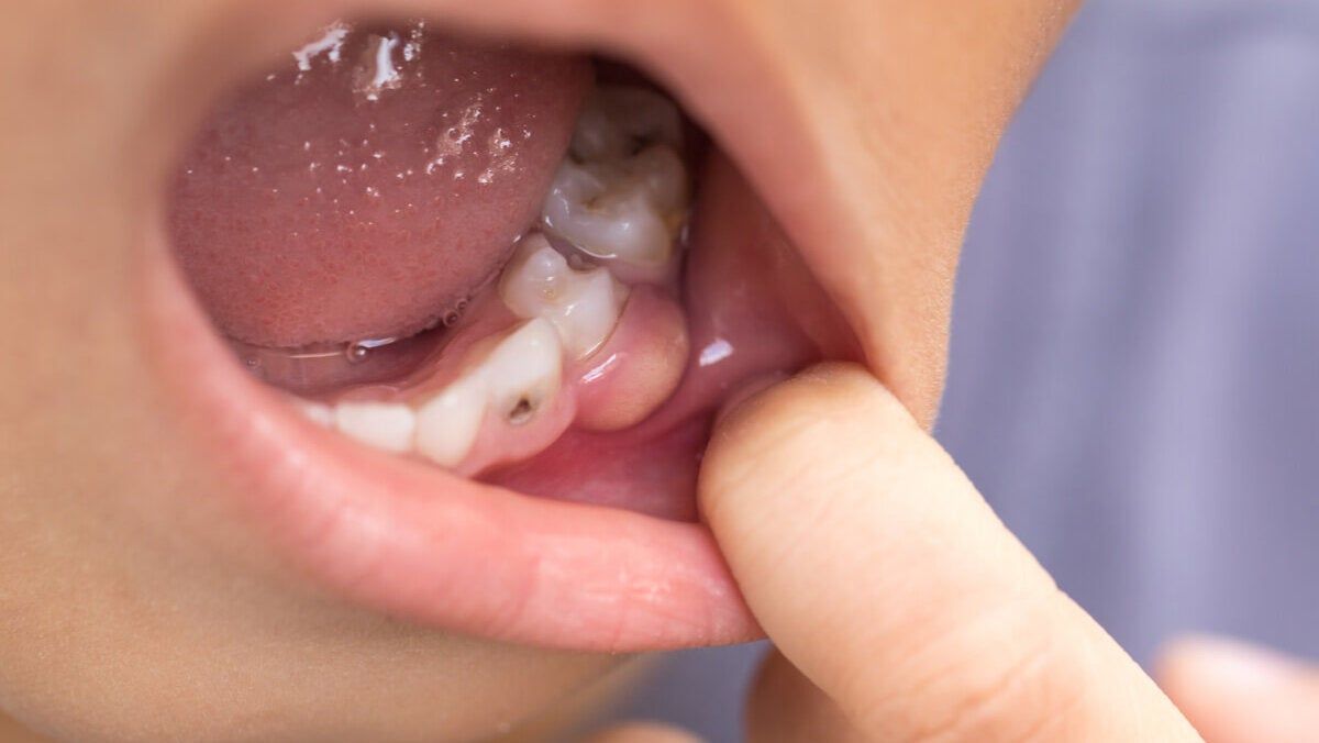 Juan Carlos Troche Chavez-14