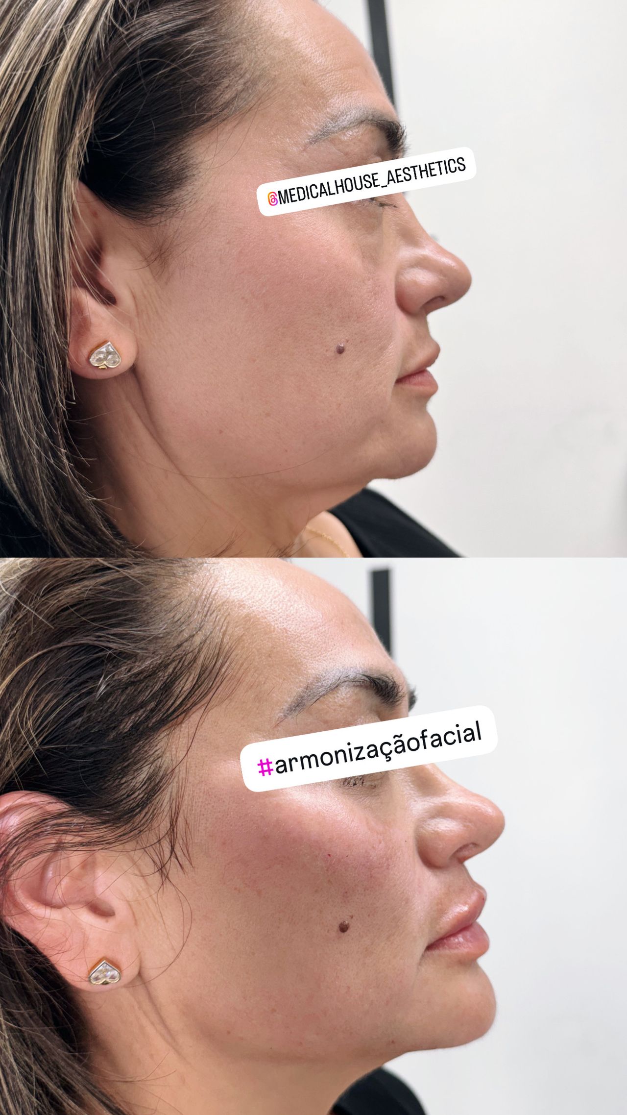 Miguel Angel Aguirre-9