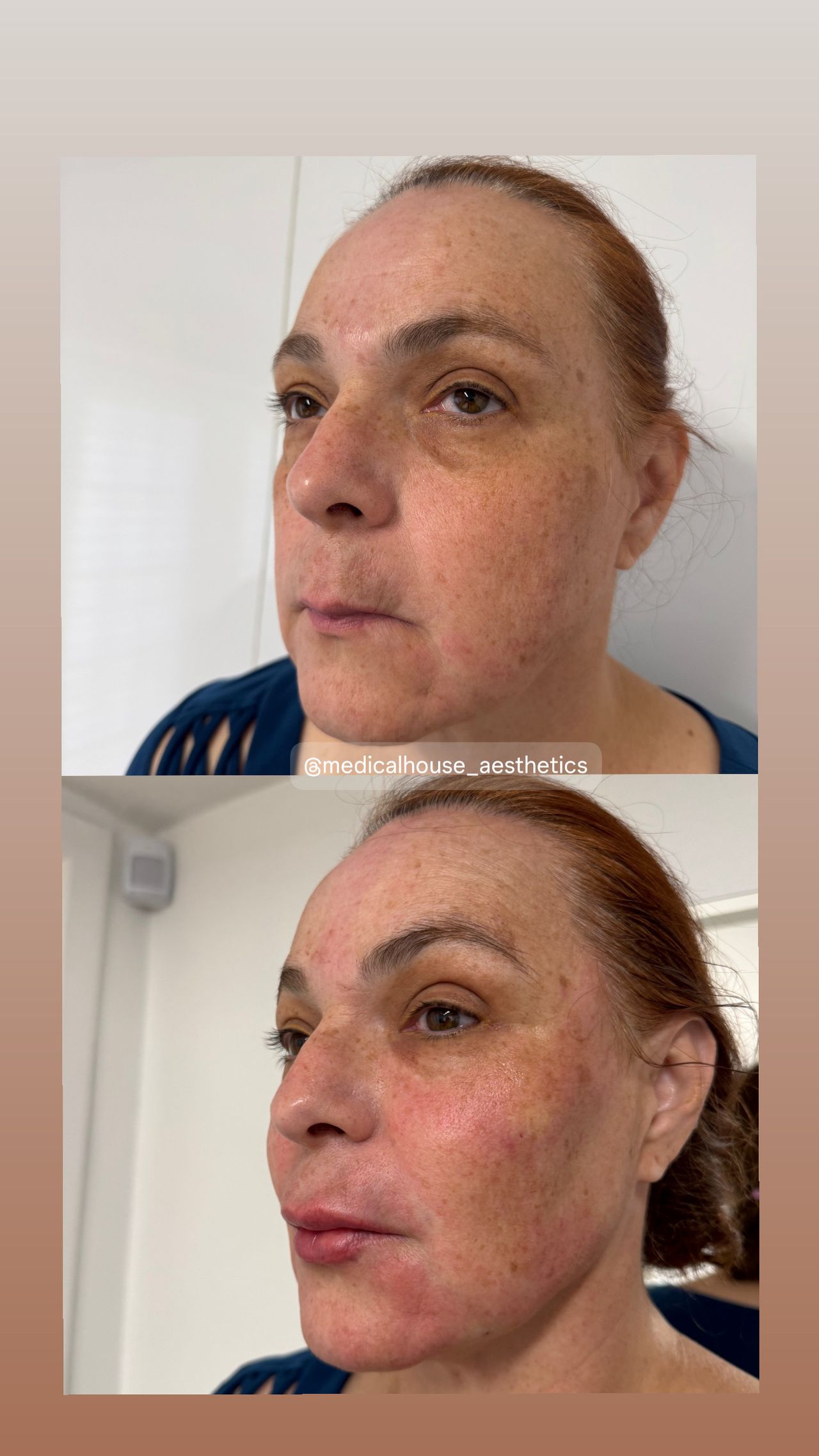 Miguel Angel Aguirre-20