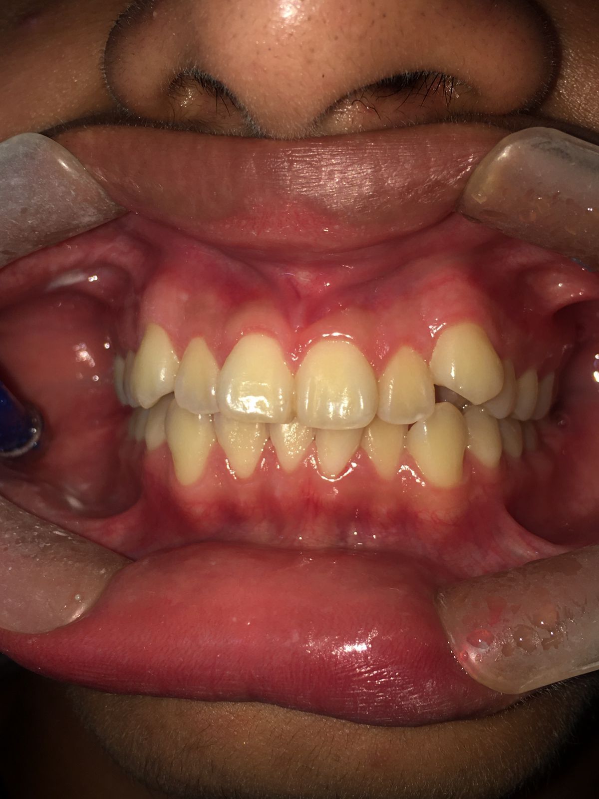 Emma Selenia Hernández Castillo-0