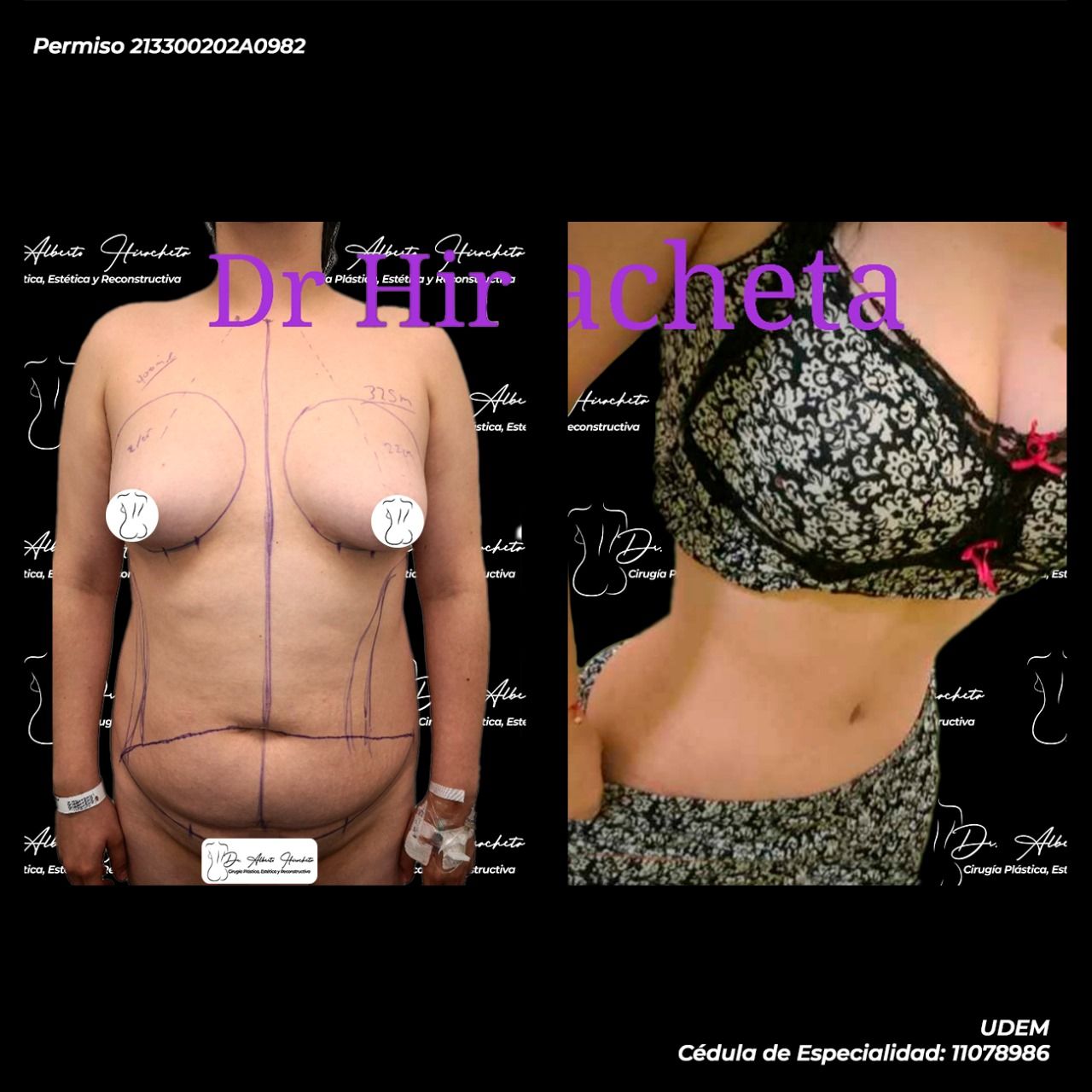 Alberto Hiracheta Torres-15