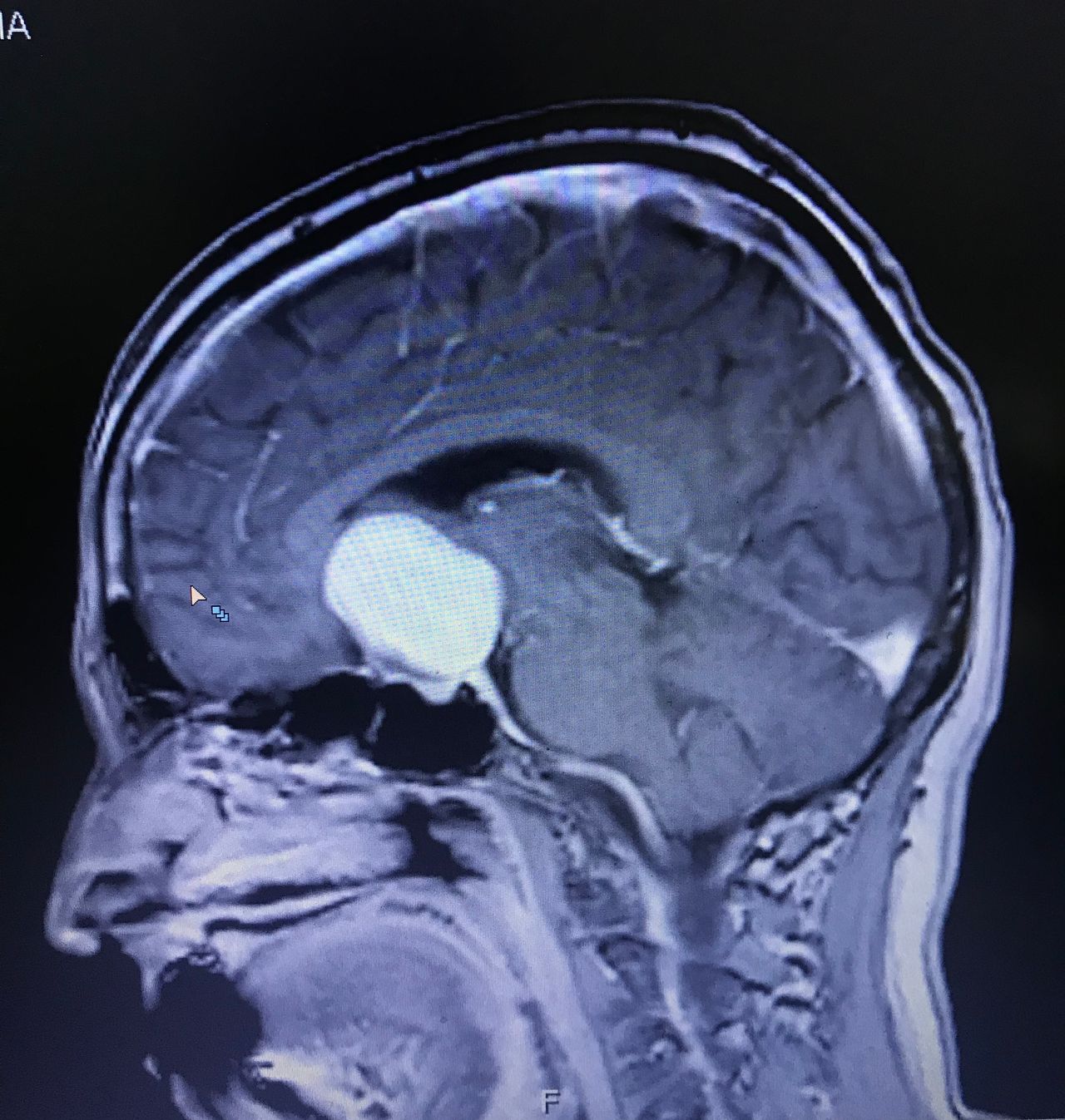 Rafael Maciel Morfin-22