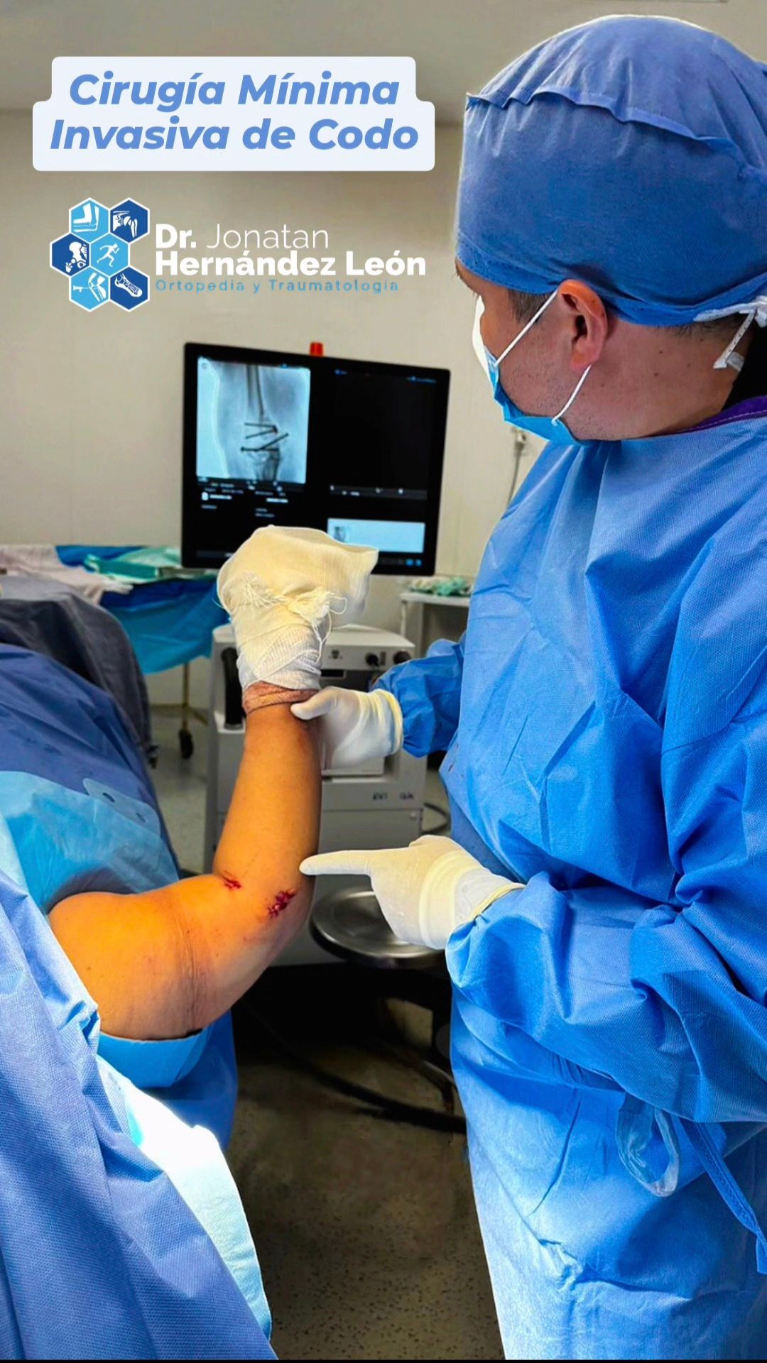 Jonatan Hernández León-28