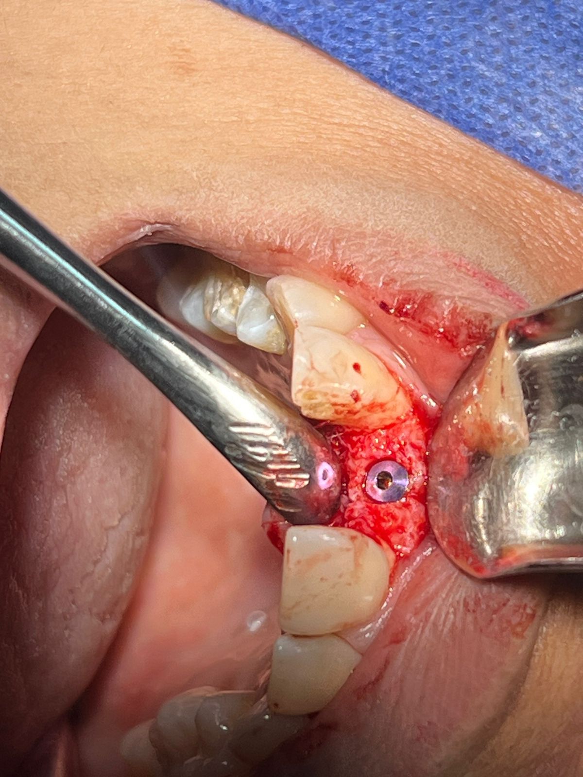 José Antonio Vázquez Mendoza-15