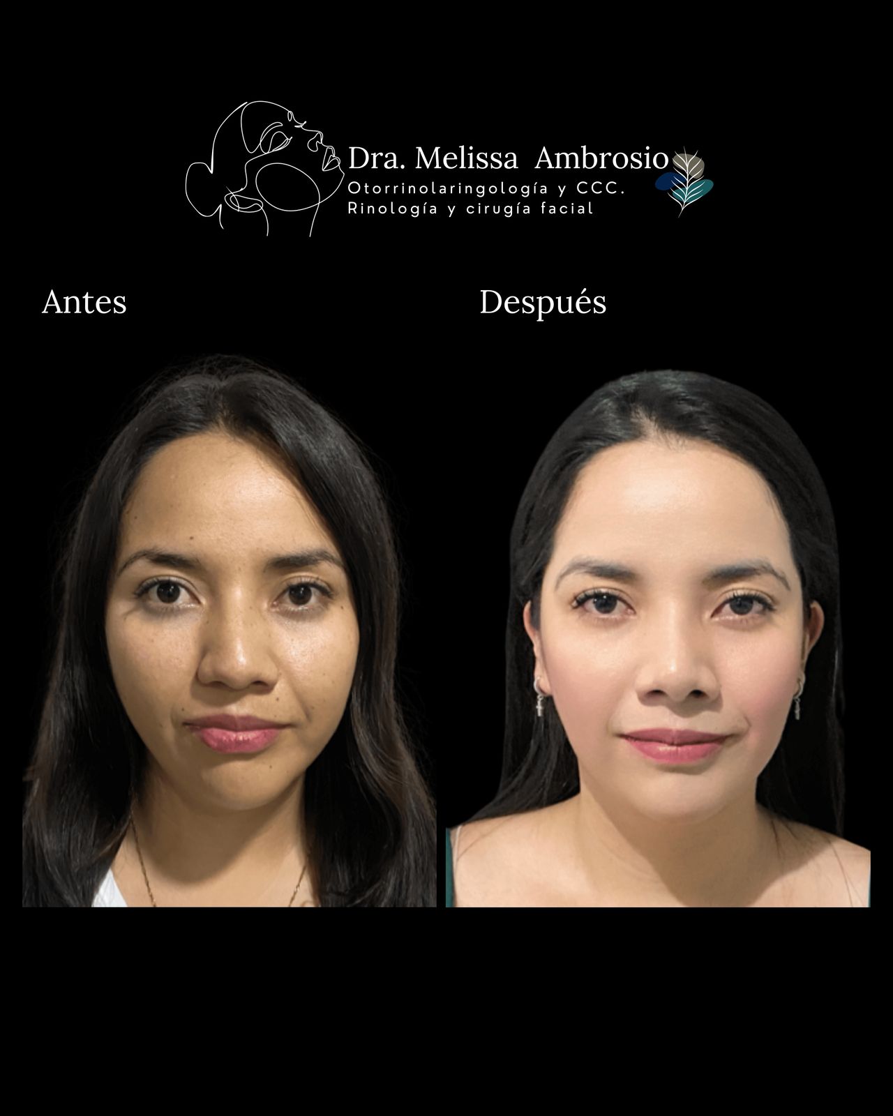 Melissa Guadalupe Ambrosio Mendoza-6