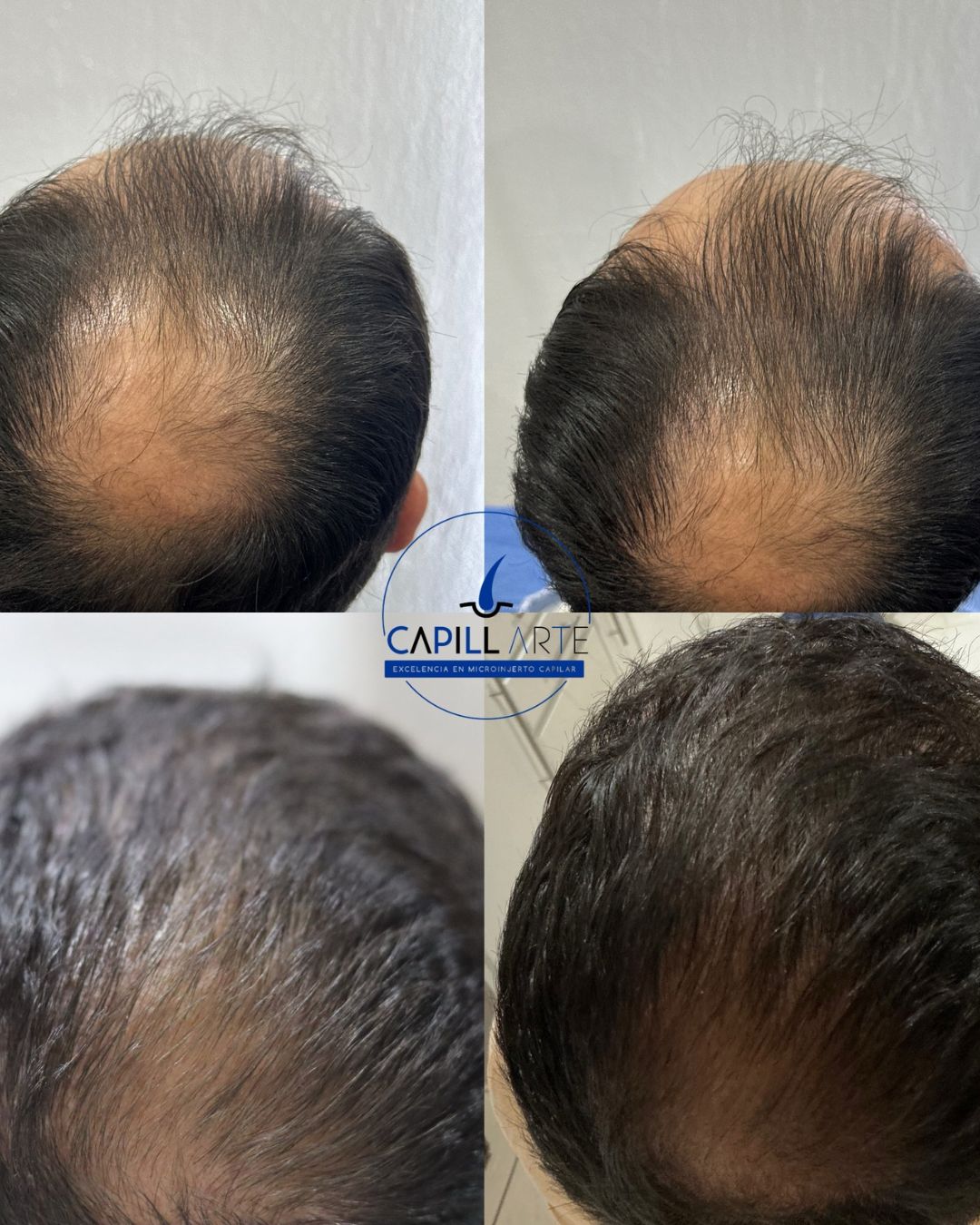 Adrian Hernandez Lopez-20