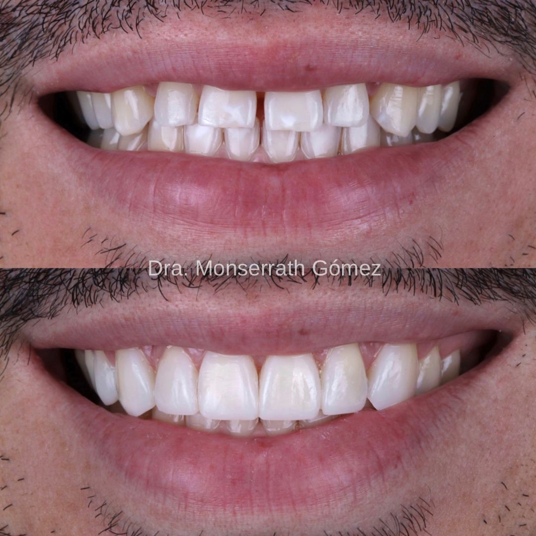 Monserrath Gomez Mendez-1