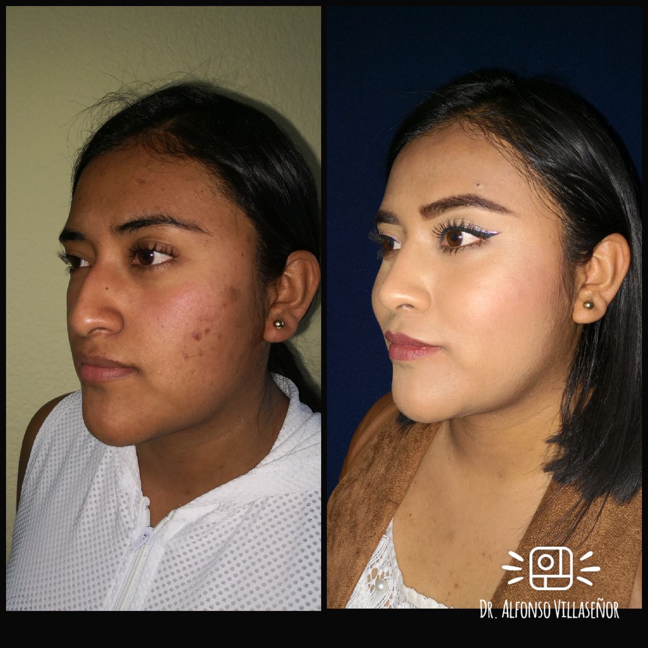 Alfonso Villaseñor Herrero-25