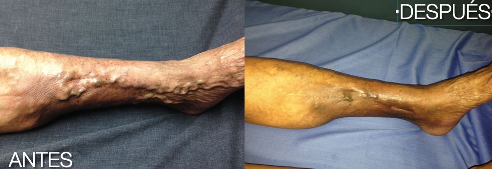 Alfredo Velasquez Maravert.-2