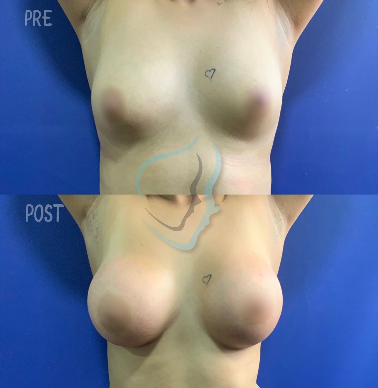 Giuseppe Tanzillo-55