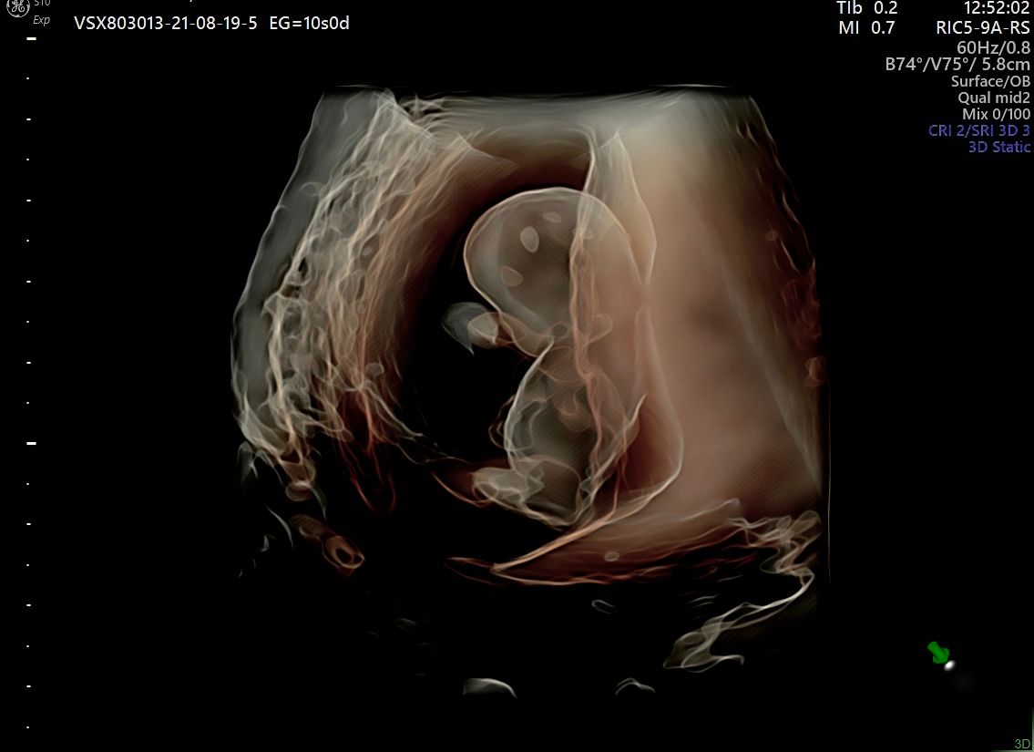 Juan Jose Pacheco Uc-12