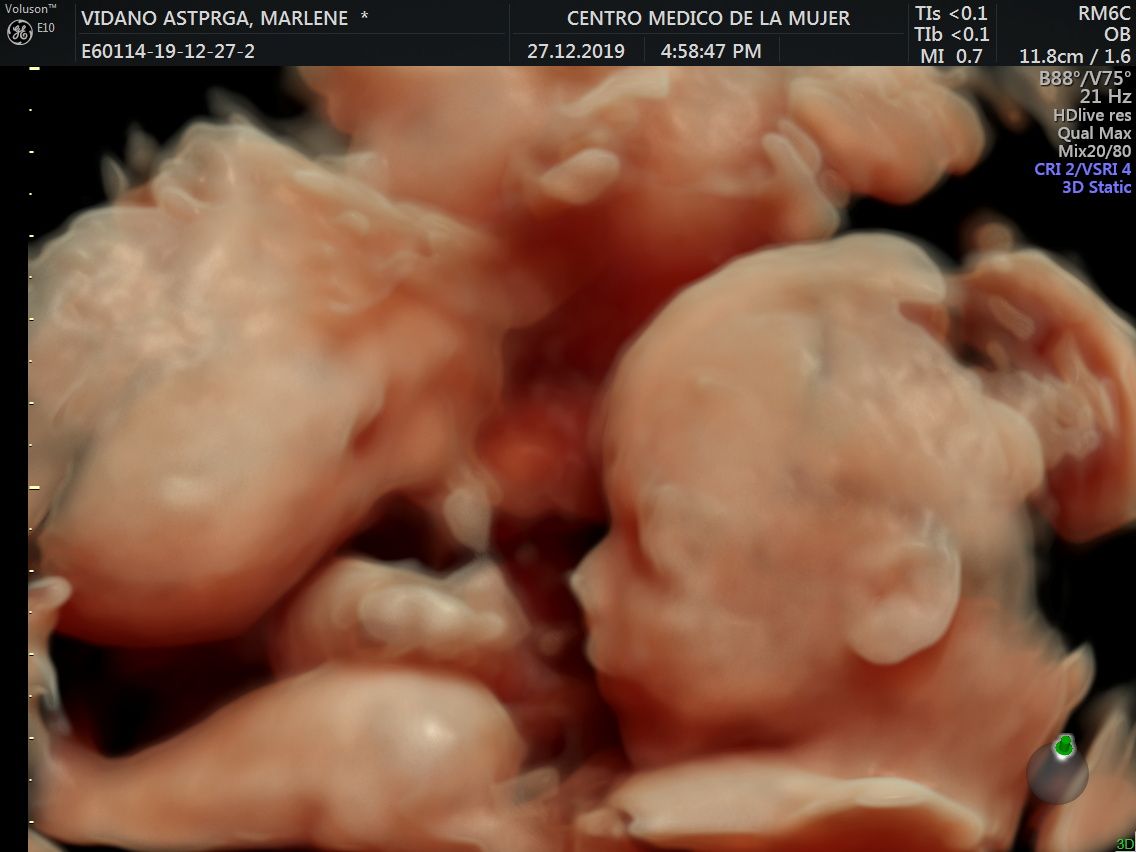 Julio Cesar Monárrez Martín-20